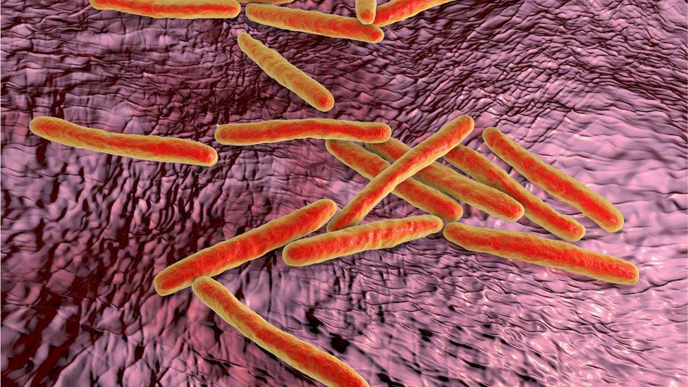 Tuberculosis or TB