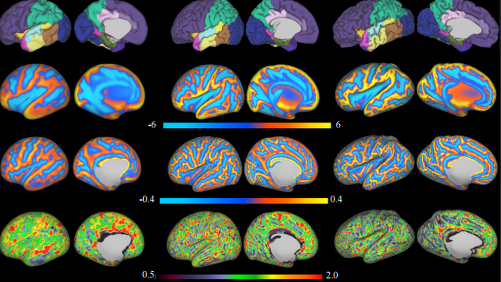 3D reconstruction of the brain's surface from newborn brain MRI data