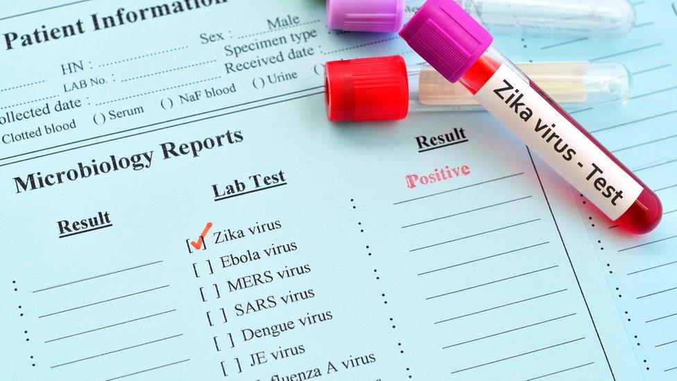 Zika virus test