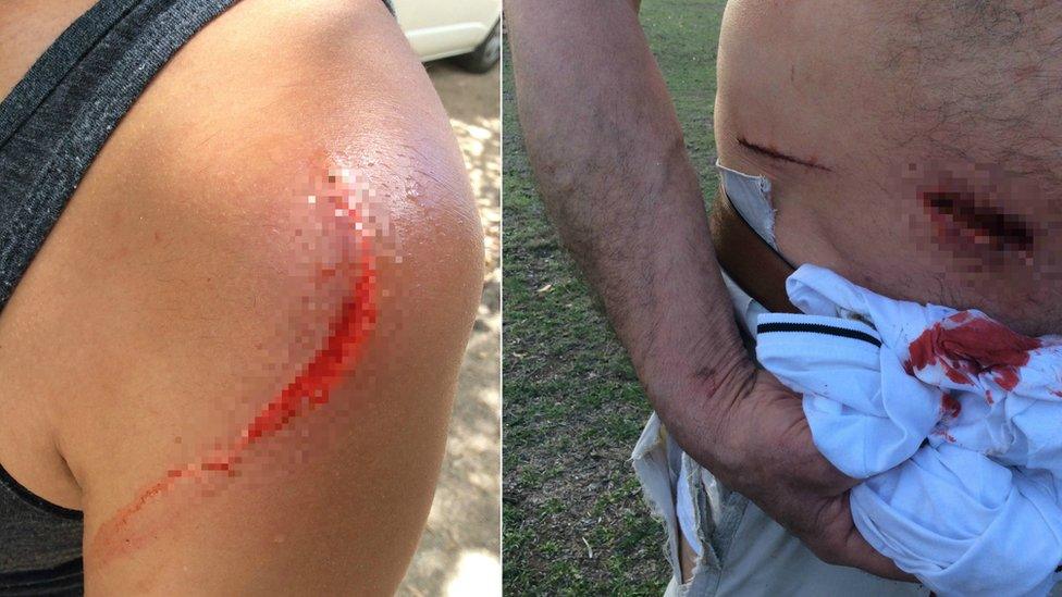 Wounds from a kangaroo