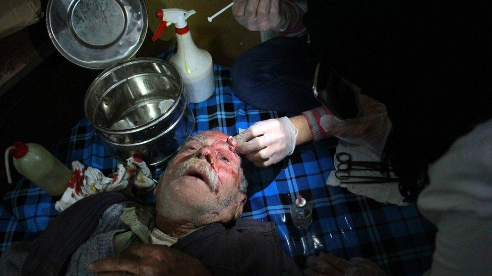 A wounded Syrian man receives first aid treatment at a makeshift hospital in Douma, in the besieged rebel-held Eastern Ghouta, on 20 February 2018