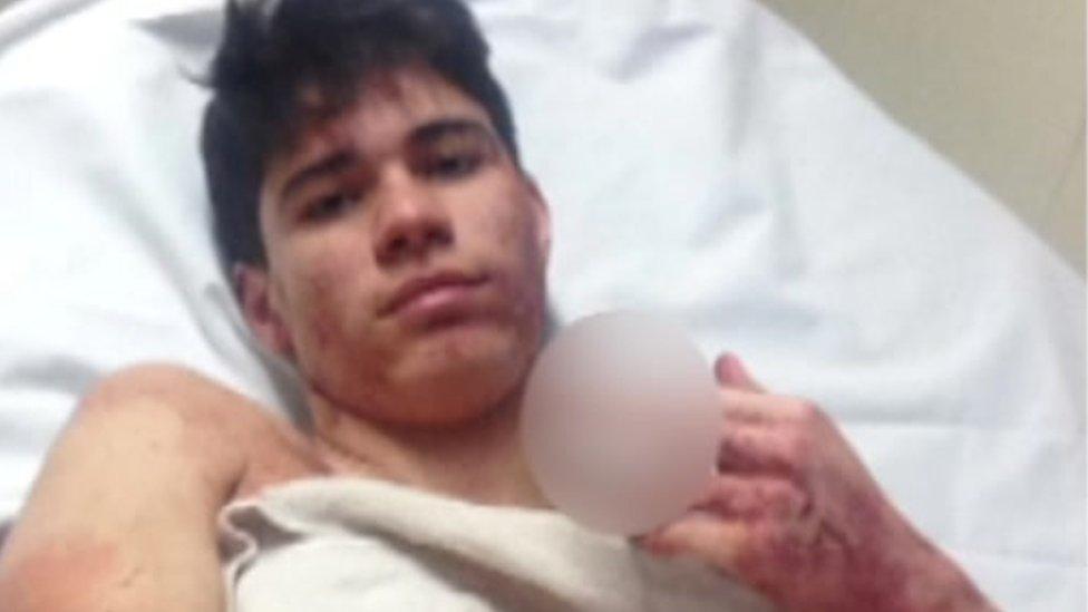 Ben Bamford in hospital bed