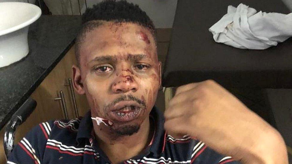 Samora Mangesi tweeted pictures of the injuries he sustained in the alleged assault