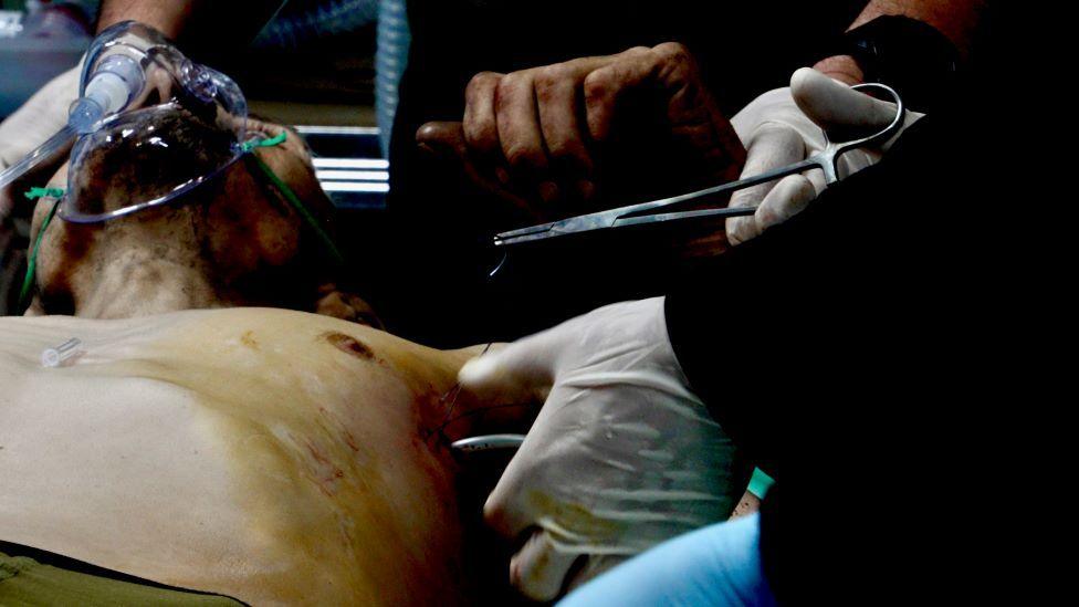 A man is lying topless, wearing a breathing mask, as a pair of hands holding pliers appears to stitch up a wound under his armpit