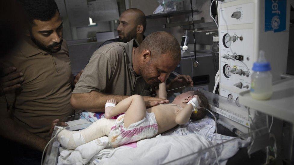 Five-month-old Palestinian baby Omar Hadidi who lost his mother and siblings in the Israeli airstrike, whose homes in Shati Refugee Camp were completely destroyed, receives medical treatment at Shifa Hospital in Gaza City, Gaza