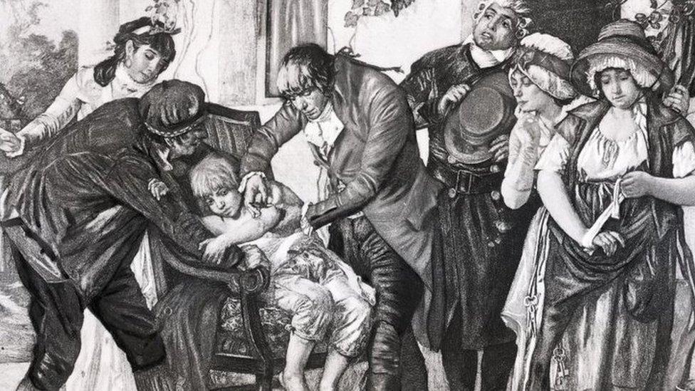 English physician Edward Jenner's first smallpox vaccination, performed on James Phipps in 1796. From a painting by GG Melingue