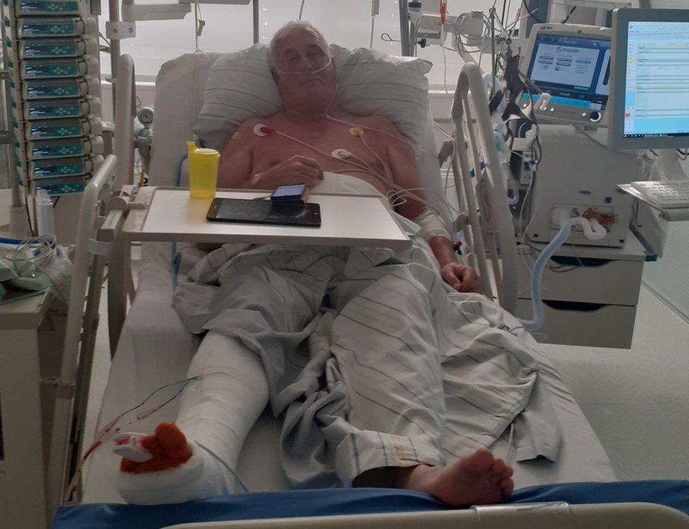 Alan Couser pictured recovering in hospital.