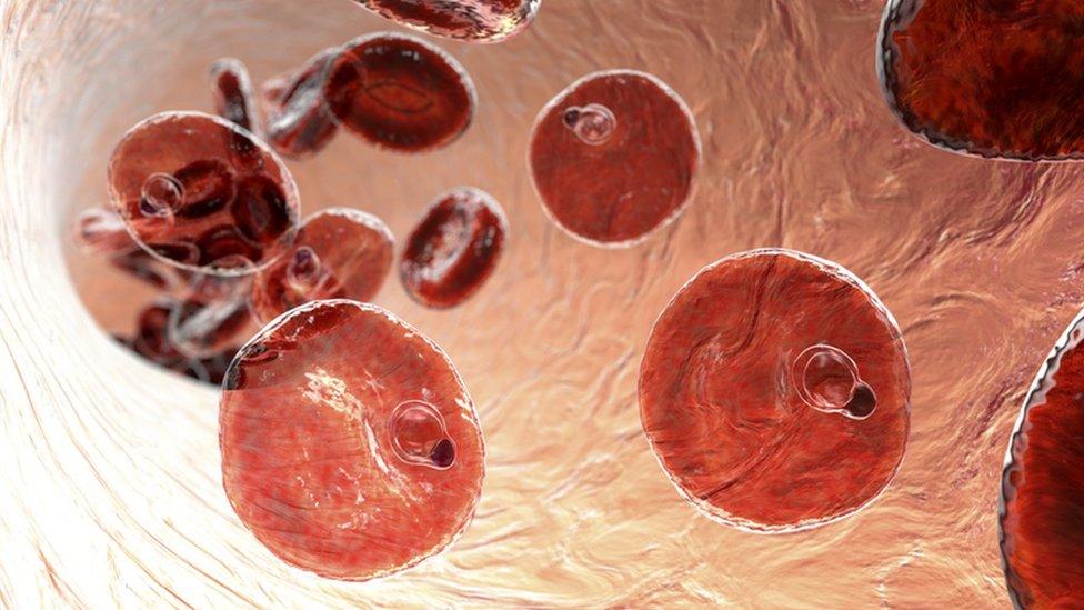 Computer illustration of malaria being transported in red blood cells