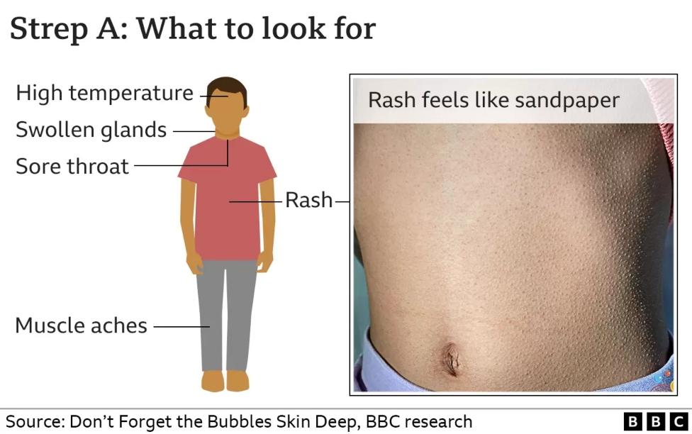 Strep A graphic