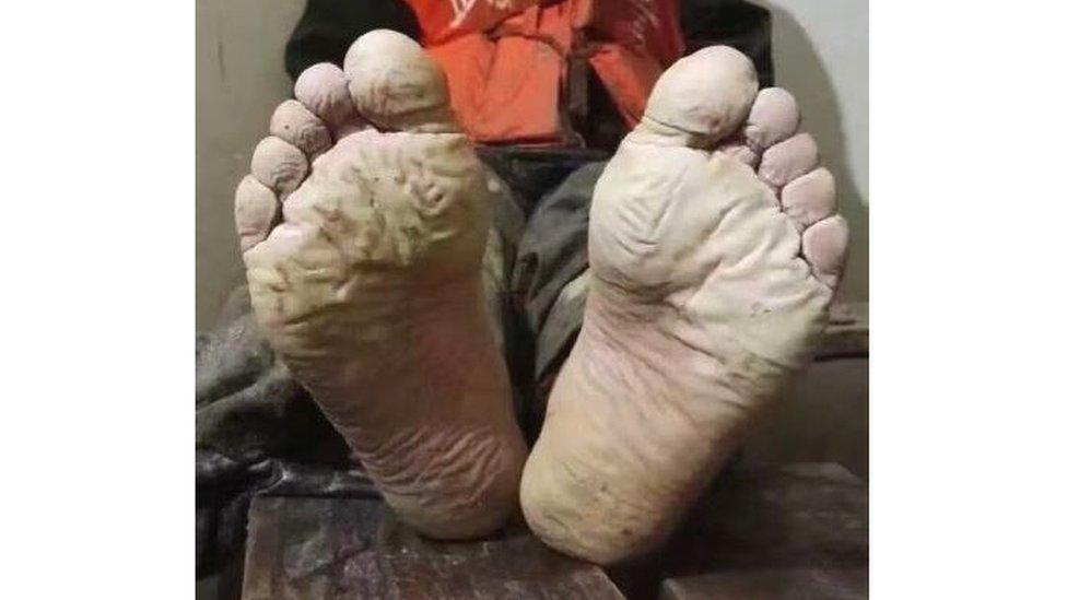 Man with mud-soaked feet taken from Weibo