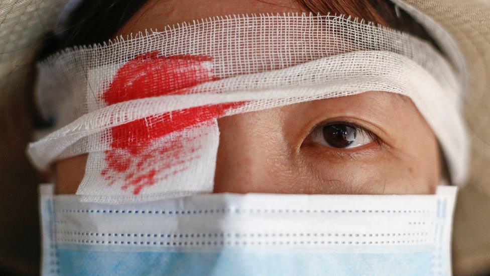 An anti-extradition bill protester wears an eye patch, in reference to a demonstrator that was injured at previous day's clashes