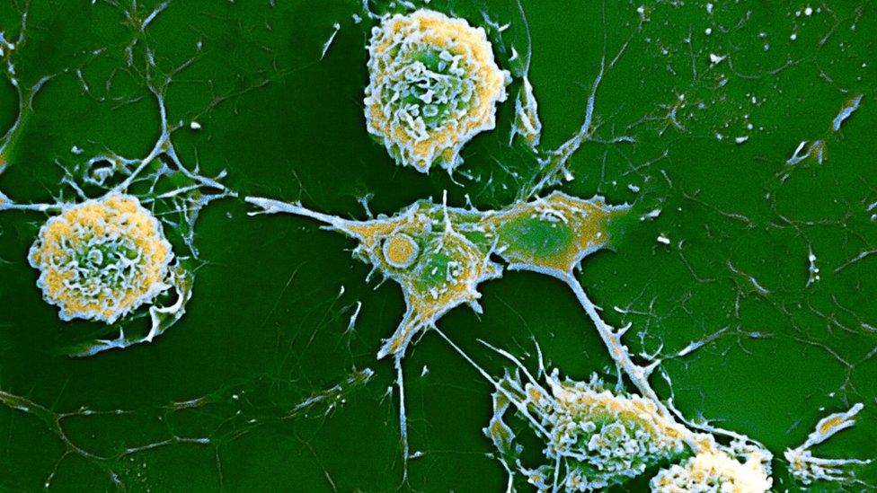 Multiple sclerosis in the body's cells