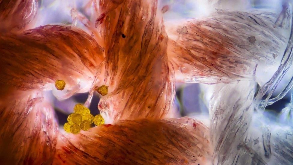 Cotton fabric fibres and pollen cells