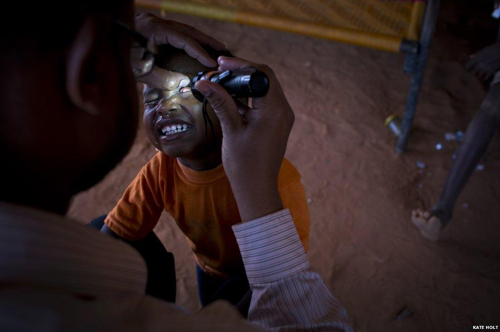 Ghosi, 3, has his eyes checked by a member of the mapping team