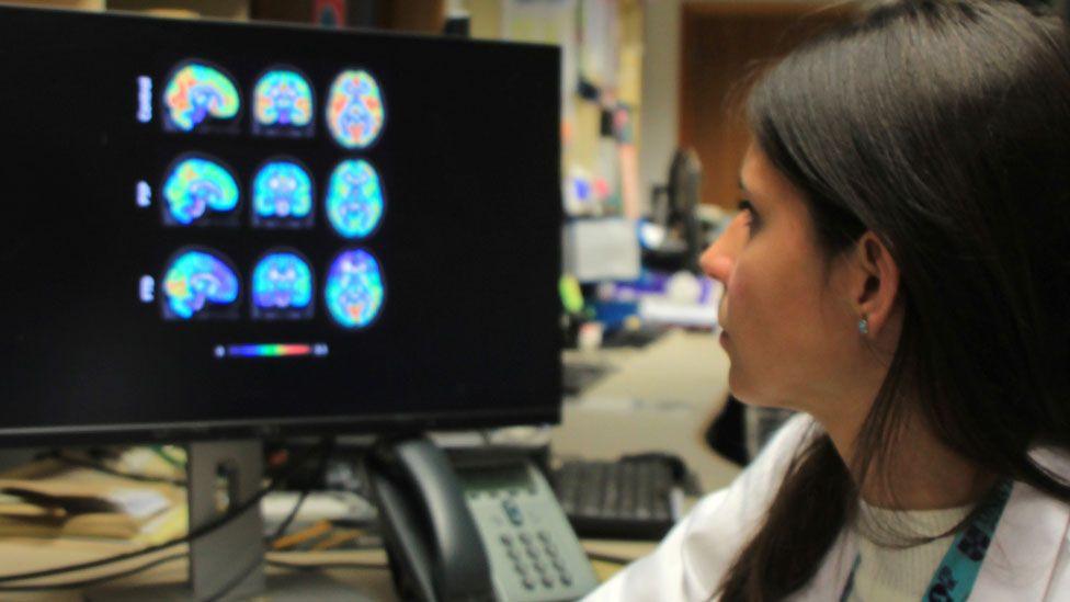 A side-on view of Dr Maura Malpetti, who has dark long hair and is wearing white lab coat over a white jumper. She is sitting at desk and twisting to look towards a computer screen which has nine brain scans lined up, all blue and purple coloured, some with orange areas. 