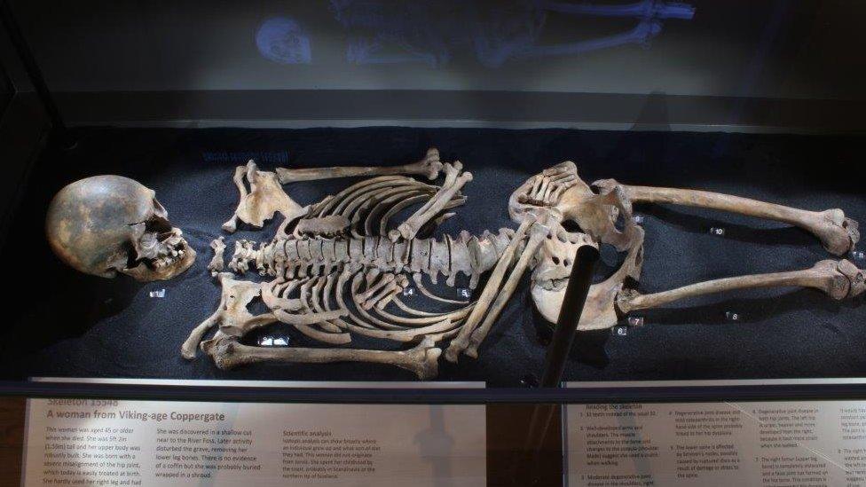 Woman's skeleton