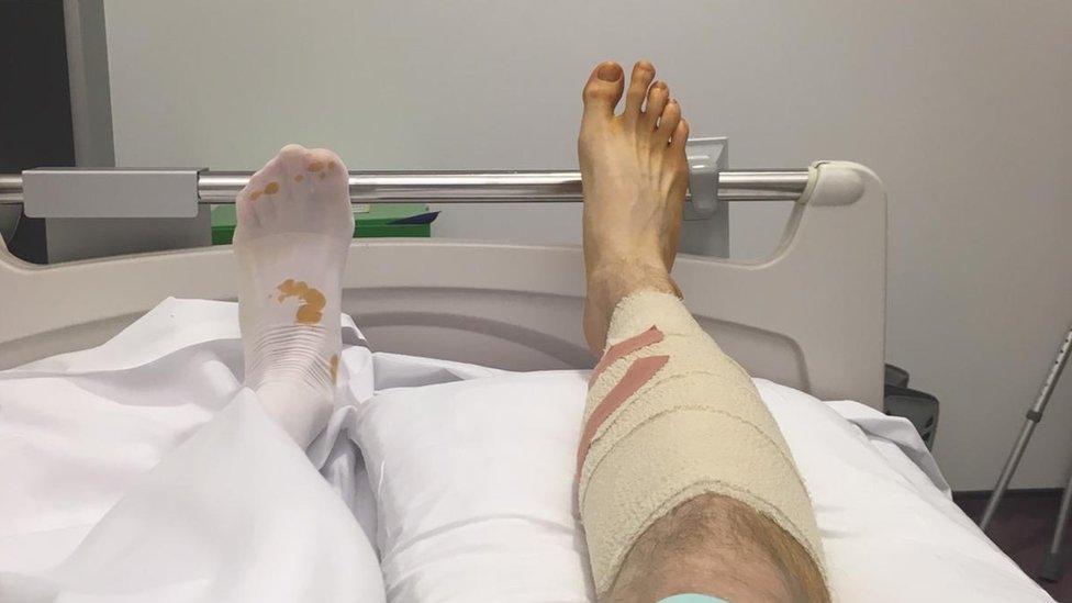 Andy Tucker's legs in hospital bed