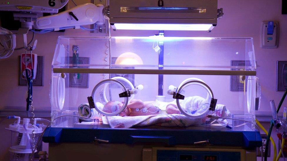 A baby in an incubator