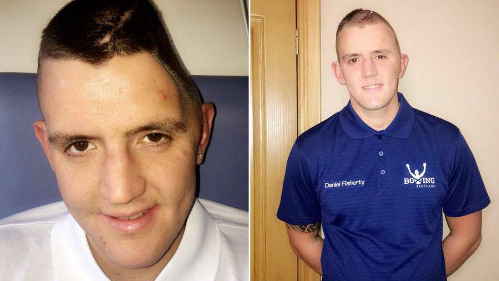 Daniel Flaherty before and after the operation to have a metal plate fitted in his skull