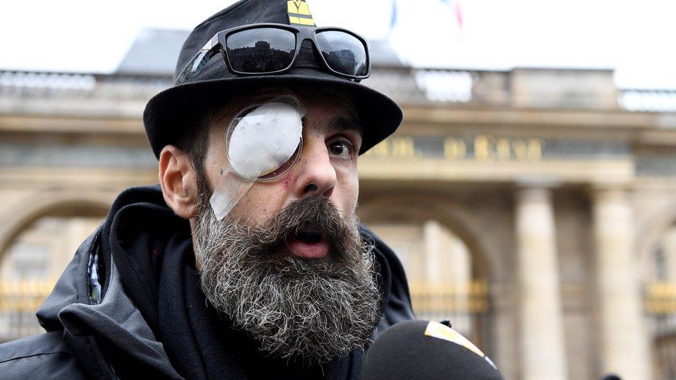 Jerome Rodrigues, one of the leading figures of the "yellow vests" (gilets jaunes) movement, speaks to the press outside the Council of State in Paris, on January 30, 2019, after he was severely injured in the eye during a "yellow vest" anti-government protest.