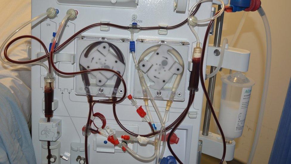 A dialysis machine