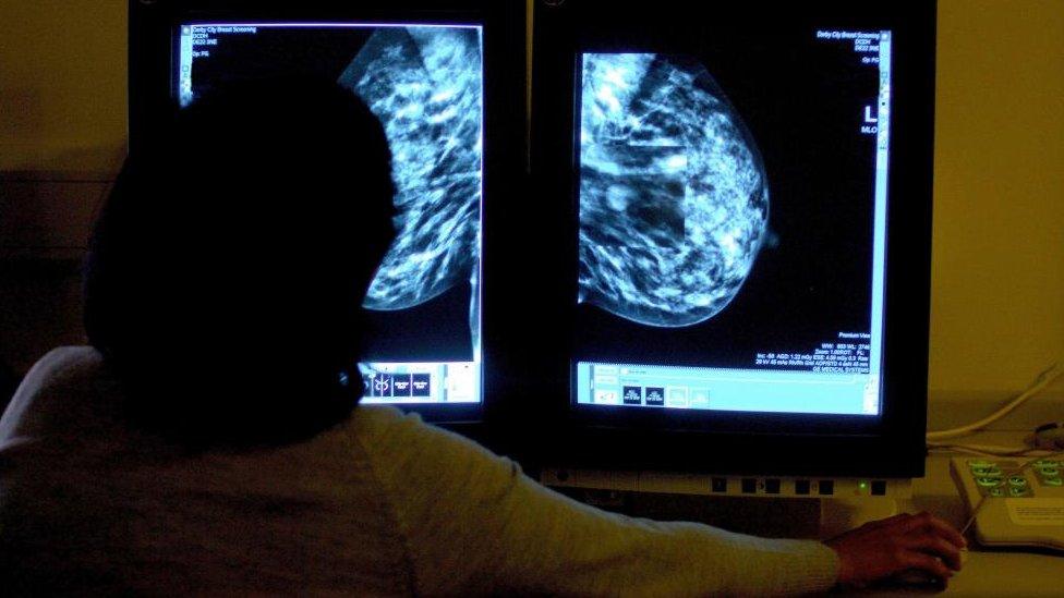 A doctor looking at a mammogram