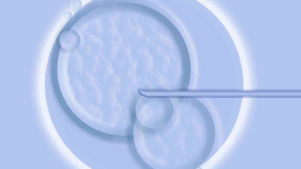 IVF treatment