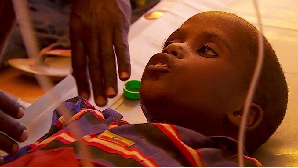 Somalian boy is treated in hospital