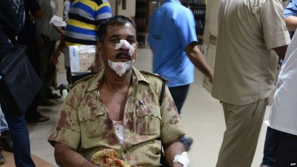 An Indian policeman injured in clashes waits for treatment at a hospital in Ahmedabad late on August 25, 2015