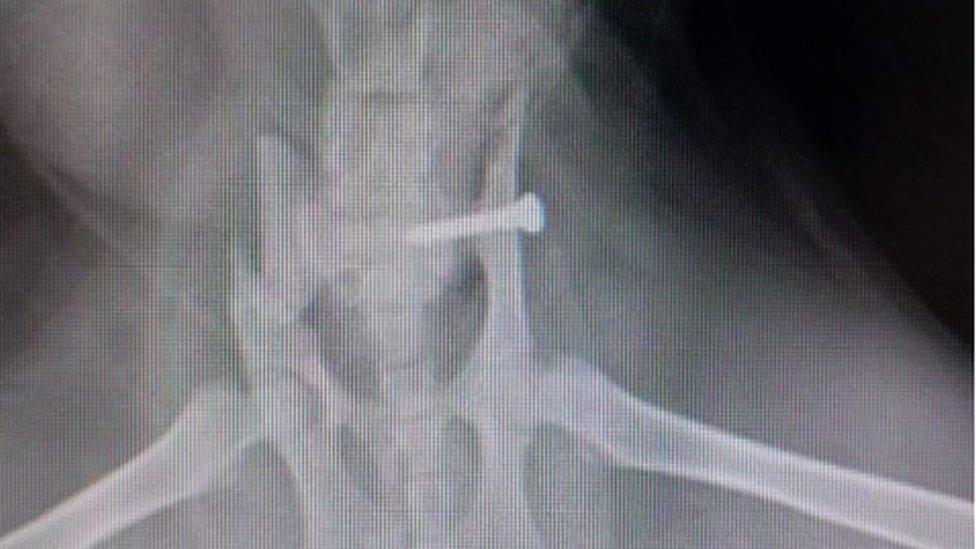 X-ray showing screw in Fifi's spine