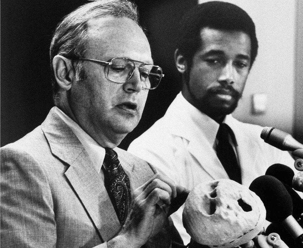 Dr. Donlin Long, director of neurosurgery, left, and Dr. Ben Carson director of pediatric neurosurgery at Johns Hopkins Hospital in Baltimore, Md.,, holds a brain model of the conjoined twins who separated in a 22-hour surgery, Sept. 7, 1987.