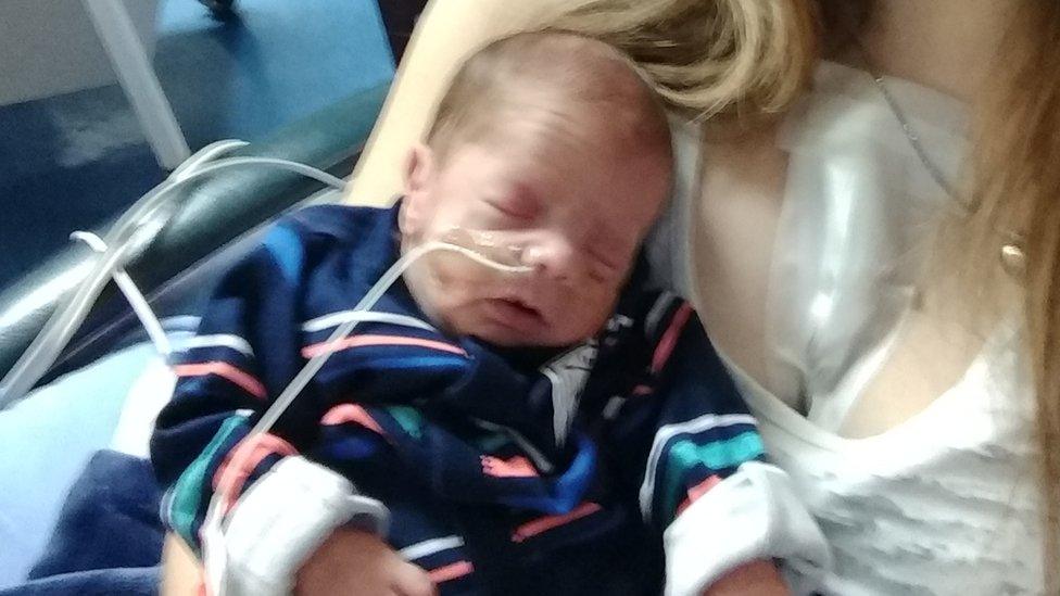 Jaxon Gallagher was born two months premature when his mother had a heart attack while pregnant