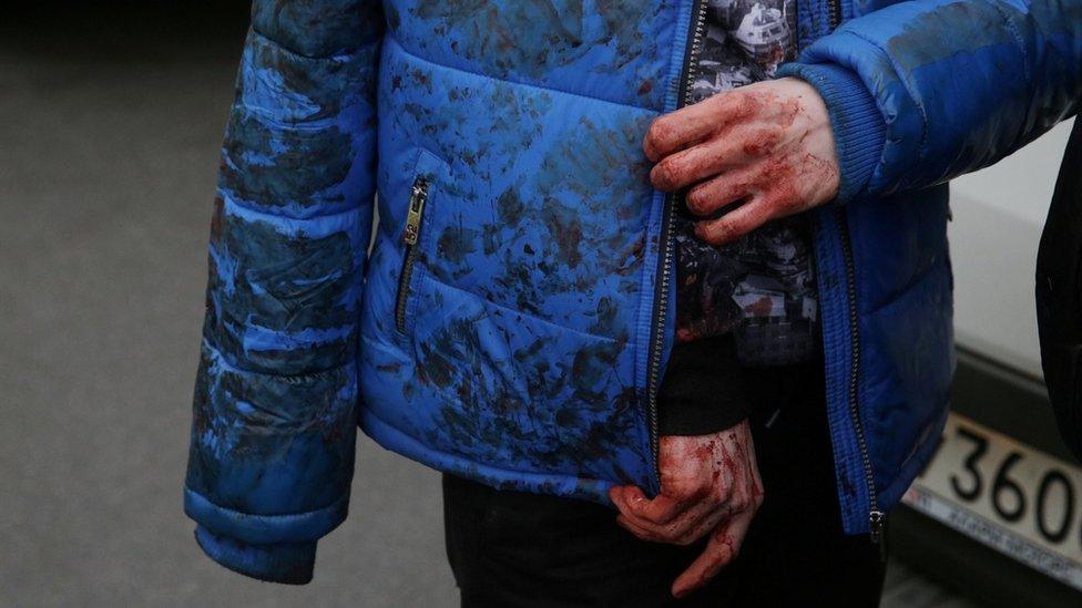 An injured commuter leaves the Sennaya Ploshchad metro station following explosions in two train carriages in St Petersburg, Russia, 3 April 2017