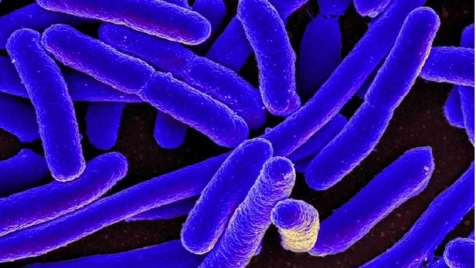 Colorized scanning electron micrograph of Escherichia coli