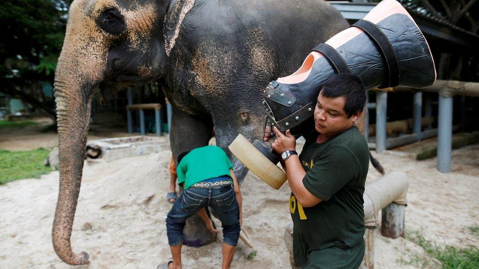 Motola prepares to have her prosthetic leg attached