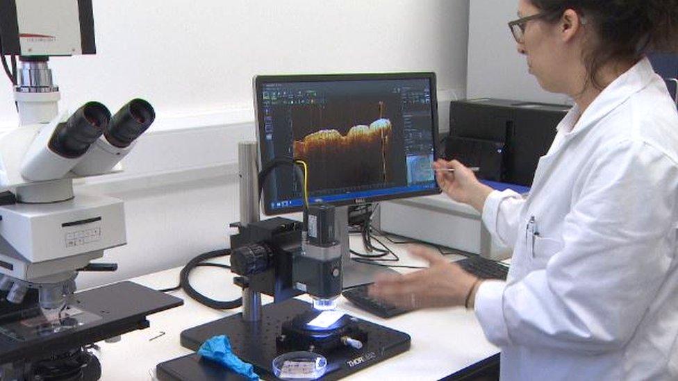 optical coherence tomography system