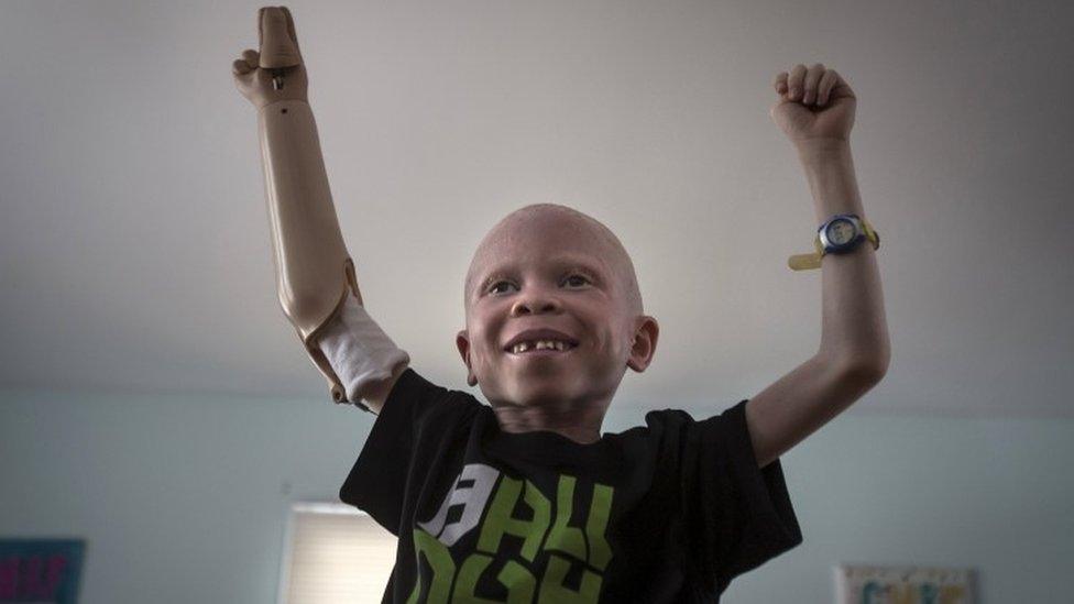 5-year-old Baraka Cosmas from Tanzania dances along as a video plays on a computer in the Staten Island borough of New York, September 21, 2015.