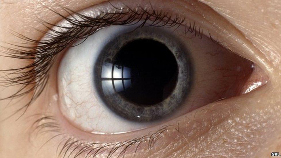 Eye