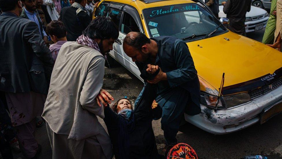 A woman injured in Kabul