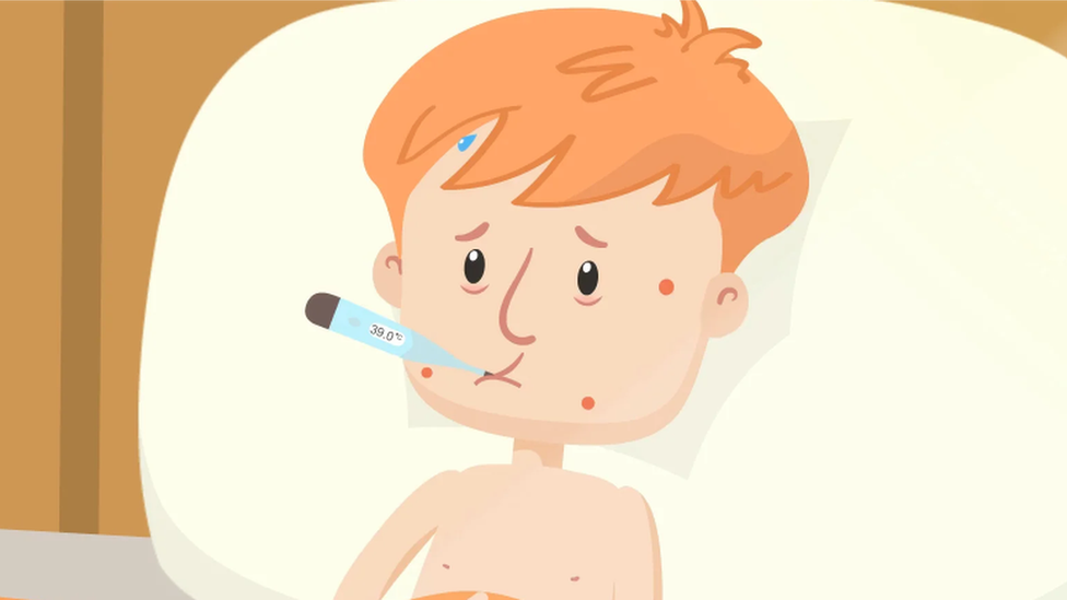 A cartoon of a young boy with measles