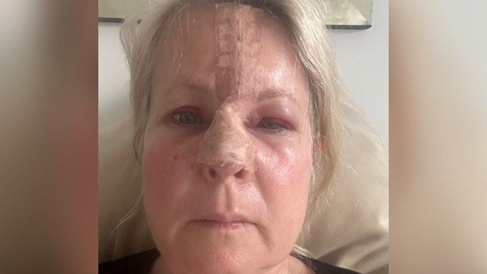 One day after surgery for skin cancer