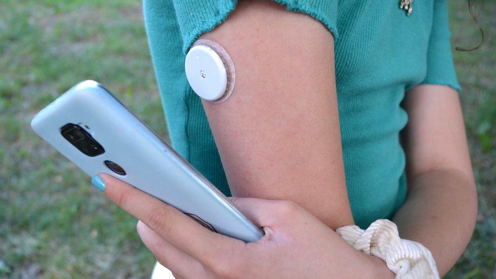 smartphone diabetes monitor