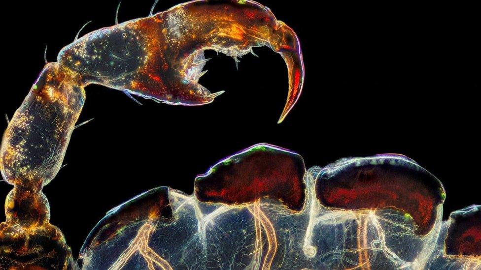 Leg, claw and breathing organs of a louse