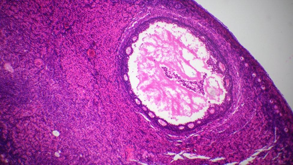 Section of ovary under the microscope