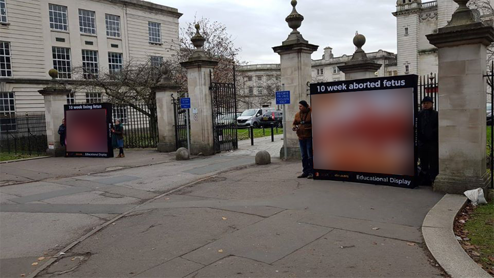 Graphic abortion images outside Cardiff University