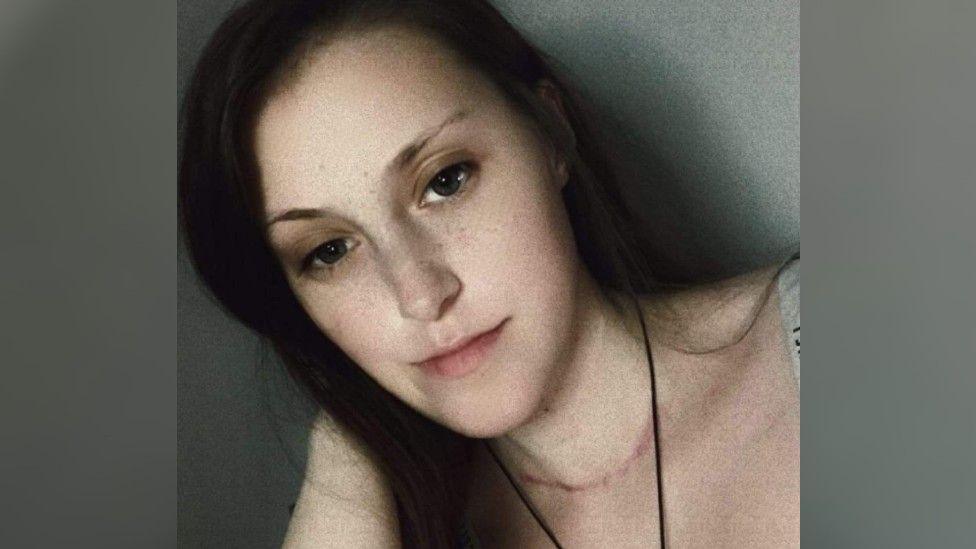 Ms Bowes in a selfie, looking into the camera. Her curved scar is visible at the base of her throat. She is slightly smiling and is wearing a black string necklace.