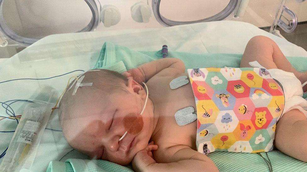 Newborn baby Roddy in an incubator at the neonatal unit. He is lying on his side asleep. He has a tube up his nose and wires attached to his chest. There are also wires attached to his skull. A cove, featuring children's characters lies across his stomach.