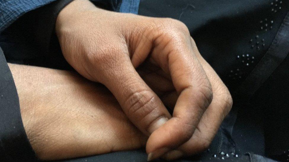 The hands of Halima. a 21-year-old Rohingya refugee who fled violence in Myanmar to be forced into prostitution in Bangladesh