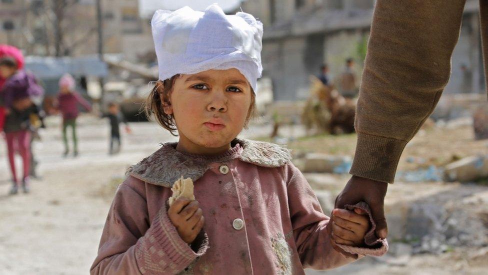 A wounded Syrian girl walks with her parents in the town of Kafr Batna, Southeastern Ghouta, on March 19, 2018.