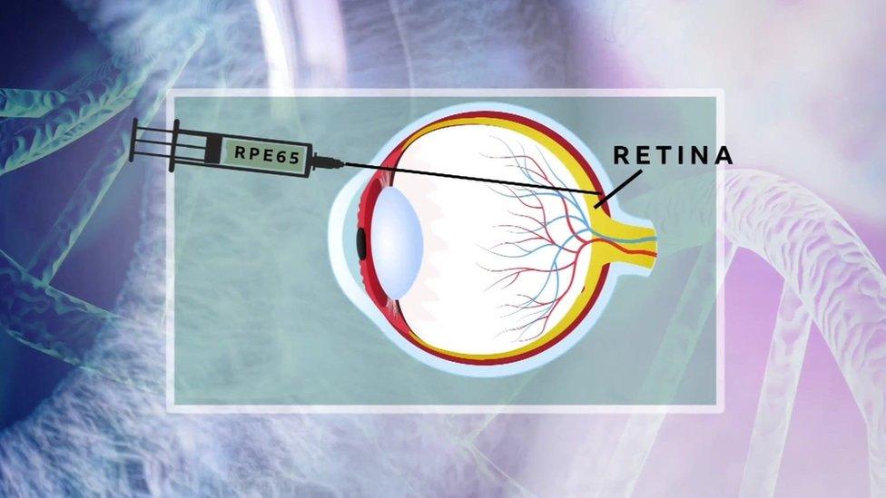 How Jake's surgery works